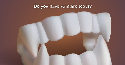 Easy Ways to Fix “Vampire” Teeth - Scott A. Tangeman, DDS